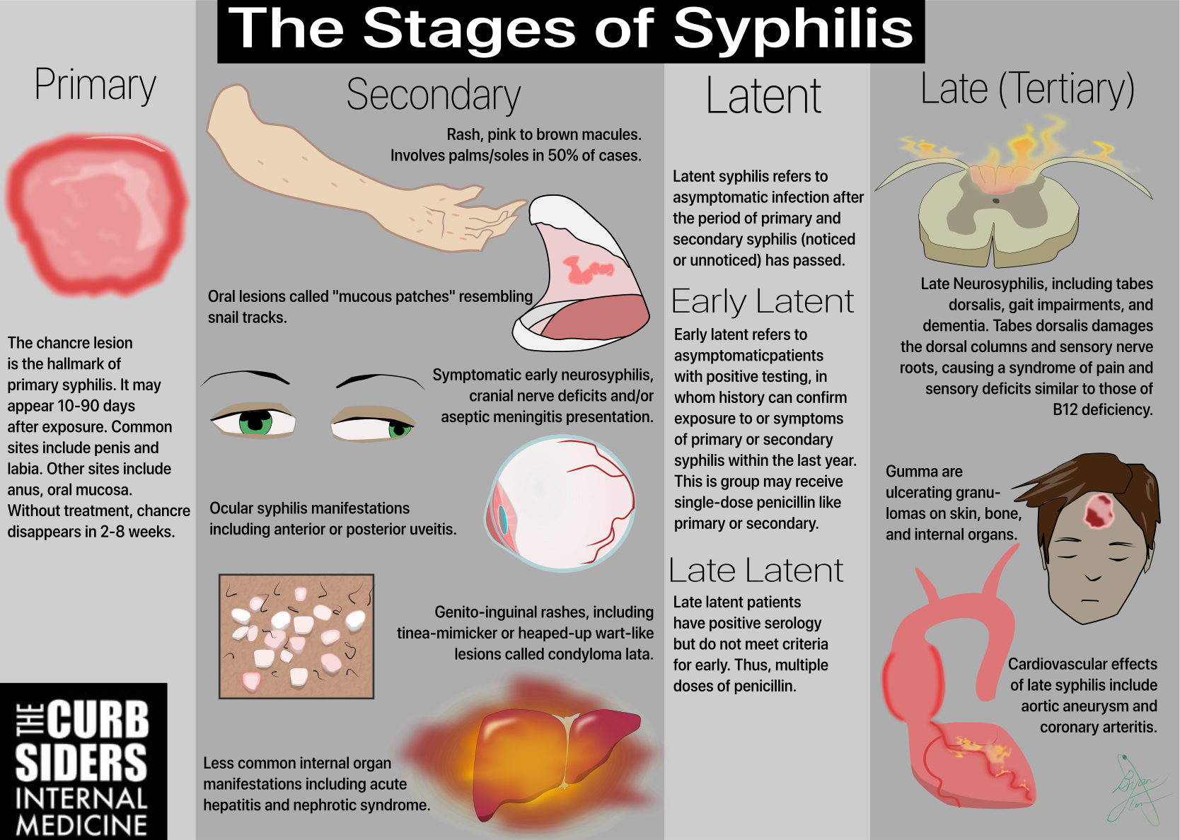 early syphilis in men