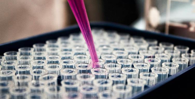 A close-up of a pipette
AI-generated content may be incorrect.